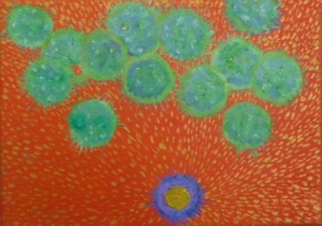 MRSA (2010) - Reinhard KIKI - Array auf Array - Array - MRSA (2010) - Reinhard KIKI - Array auf Array - Array -